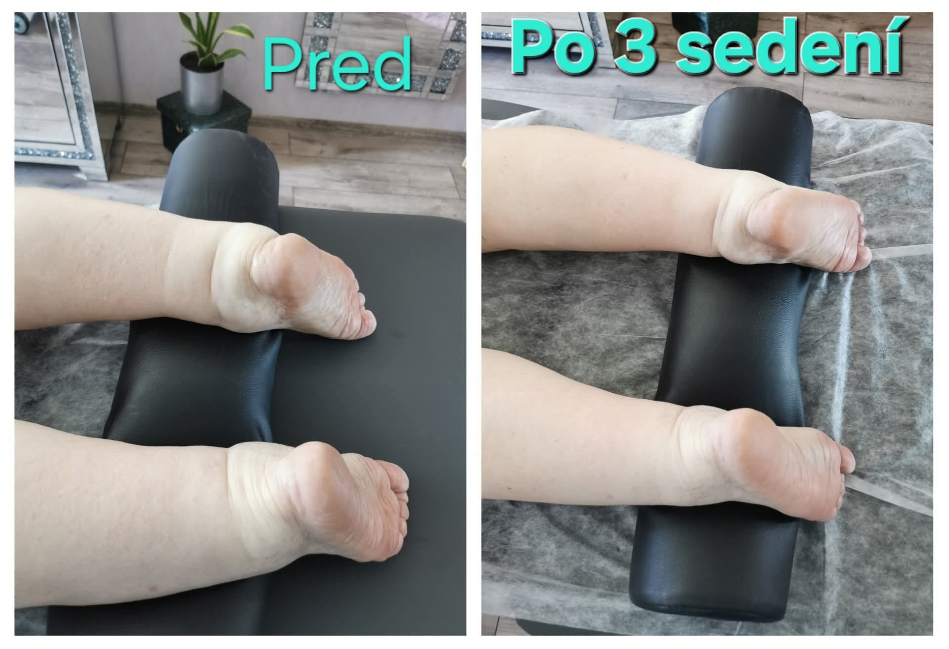 Porovnávacia fotografia pred a po troch sedeniach